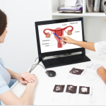 تكيس المبايض وعلاقته بالتخسيس